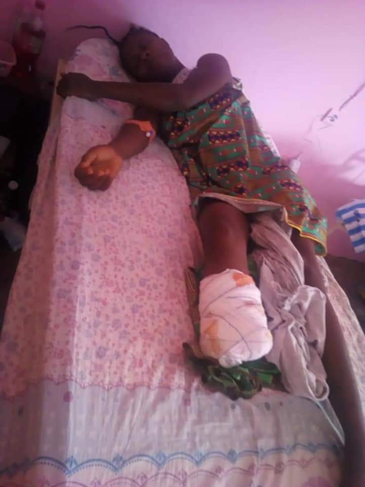 Cameroun : Il coupe les pieds de sa femme car il n’a pas trouvé les spaghettis dans la marmite