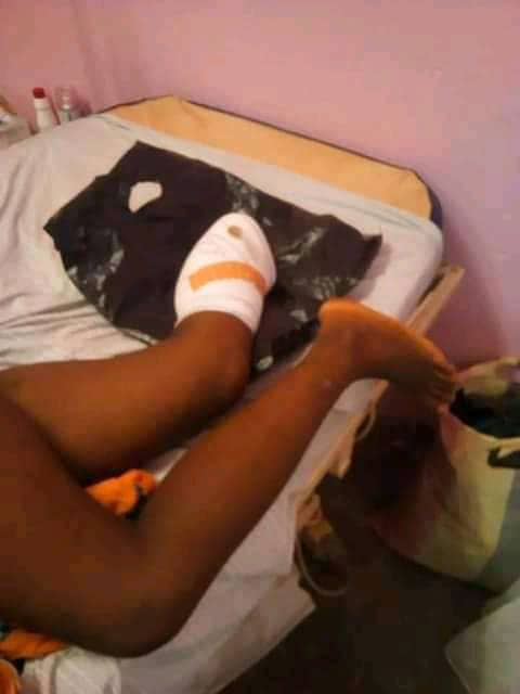 WhatsApp Image 2021 06 28 at 20.46.03 - Cameroun : Il coupe les pieds de sa femme car il n'a pas trouvé les spaghettis dans la marmite