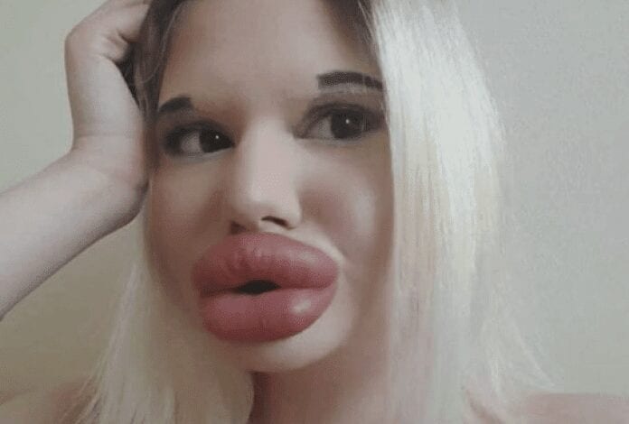 Andrea Ivanova : l’étudiante avec les « plus grosses lèvres du monde » veut les augmenter (photos)
