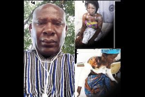 Ghana : Un Homme De 54 Ans Verse De L’acide Sur Son Ex-Petite Amie De 22 Ans