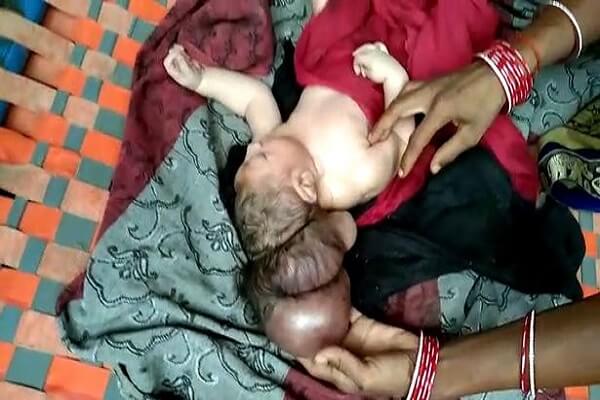 Inde : Un bébé né avec trois têtes considéré comme l’incarnation de dieu (photos)