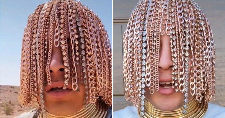 Incroyable: Découvrez  »le premier rappeur » à se faire des implants de chaînes en or pour remplacer ses cheveux