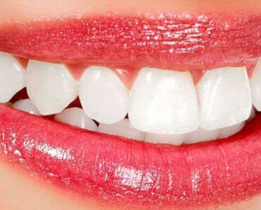 Blanchiment des dents : 6 astuces de blanchiment simples et naturelles