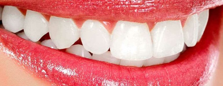 Blanchiment Des Dents : 6 Astuces De Blanchiment Simples Et Naturelles