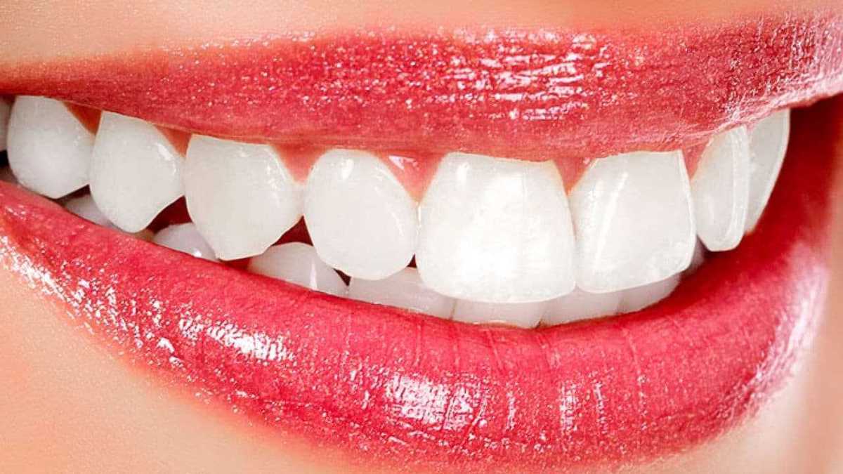 5 Remèdes Maison Pour Blanchir Naturellement Vos Dents