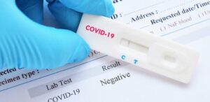 Covid-19 : Les Nouveaux Cas Positifs Augmentent, Le Sénégal Dépasse Les 74.000 Contaminations