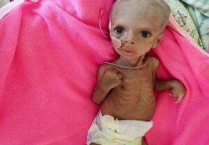 Éthiopie : Un Bébé De Trois Mois Incapable De Nourrir Sa Mère À Cause De La Guerre (Photos)