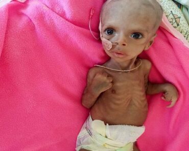 Éthiopie : Un Bébé De Trois Mois Incapable De Nourrir Sa Mère À Cause De La Guerre (Photos)