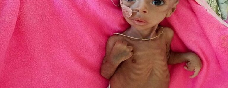 Éthiopie : Un Bébé De Trois Mois Incapable De Nourrir Sa Mère À Cause De La Guerre (Photos)