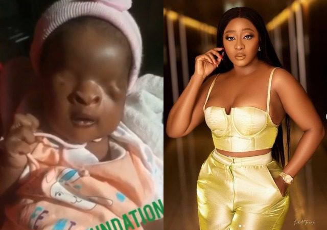 Nigeria Un Bébé Nait Sans Yeux Lactrice Ini Edo Lance Un Appel