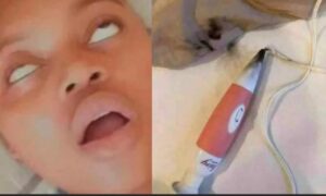 En Plein Orgasme, Son Vibromasseur Explose Dans Son Vag*N ; Les Dégâts Sont Énormes ! (Photos)