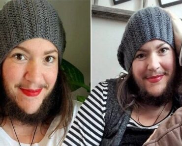 « J’avais Honte » : Après Plusieurs Années À Cacher Sa Barbe, Elle La Dévoile Au Monde Entier