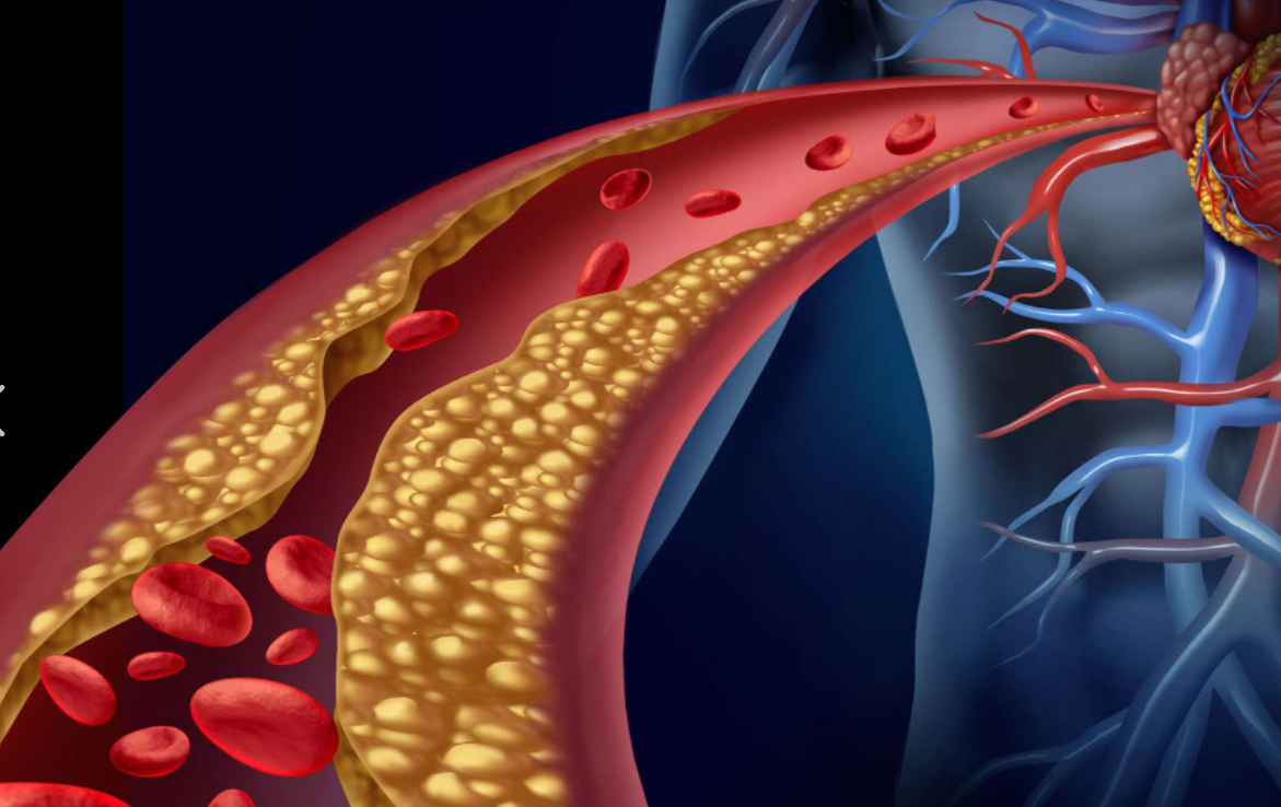 Cholesterol