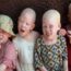 Malawi / Meurtre d’une personne atteinte d’albinisme : le coupable condamné à 155 ans de prison