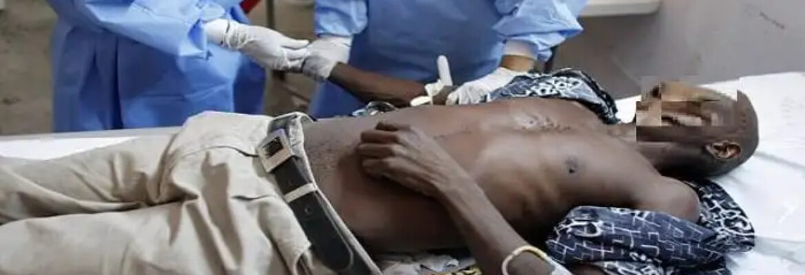 Choléra au Cameroun : L’épidémie fait rage dans le pays, 140 morts enregistrés