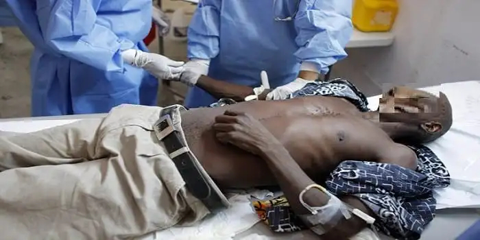 Malawi : au moins 400 personnes mortes du choléra