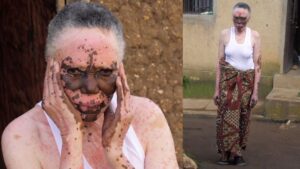 Vidéo – « Je Suis Une Femme Noire Qui Blanchit Lentement »: L&Rsquo;Histoire Touchante De Cette Femme De 75 Ans Qui Vous Fait Pleurer