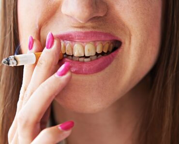 Découvrez Comment Le Tabac Affecte La Santé Dentaire D&Rsquo;Une Personne