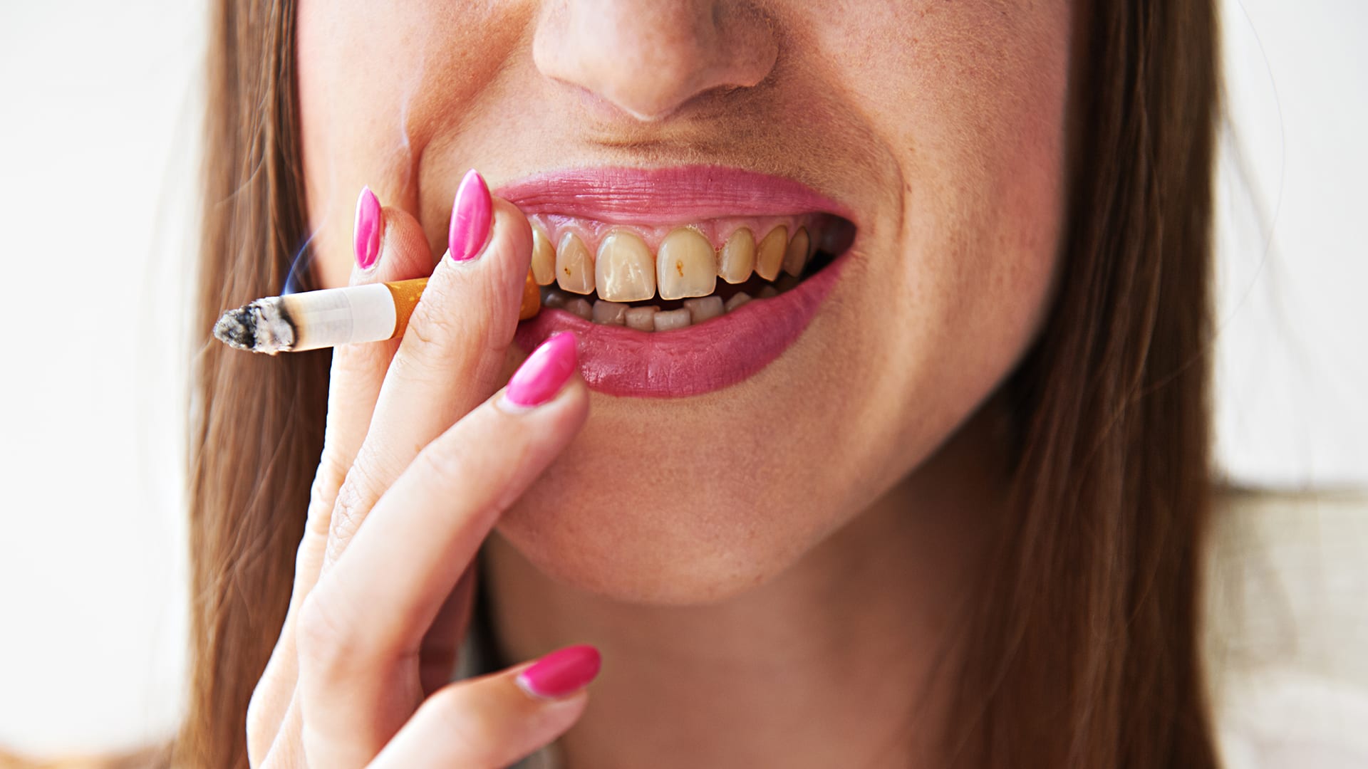 Découvrez Comment Le Tabac Affecte La Santé Dentaire D'Une Personne