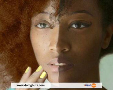 Le gouvernement camerounais lutte contre le blanchiment de la peau