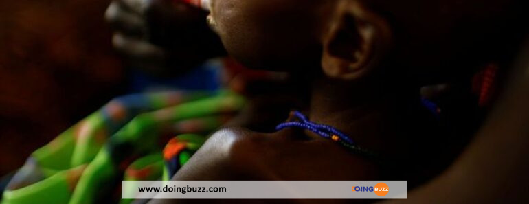 Onu : Environ 730 Enfants Morts Dans Des Centres De Nutrition En Somalie