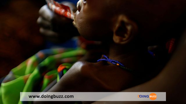 Onu : Environ 730 Enfants Morts Dans Des Centres De Nutrition En Somalie