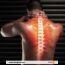 Qu’est-ce que le cou technique et comment cela affecte-t-il votre colonne vertébrale ? astuces pour y faire face