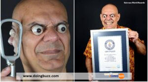 Guinness World Records : Voici Sidney De Carvalho Mesquita Qui Sort Ses Yeux De Près De 2 Cm De Leurs Orbites