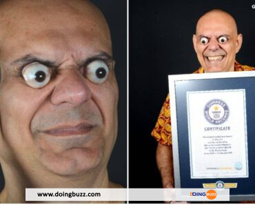 Guinness World Records : Voici Sidney De Carvalho Mesquita Qui Sort Ses Yeux De Près De 2 Cm De Leurs Orbites