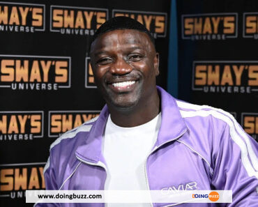 Akon : Voici La Folle Somme Qu&Rsquo;Il A Dépensée Pour Sa Greffe De Cheveux