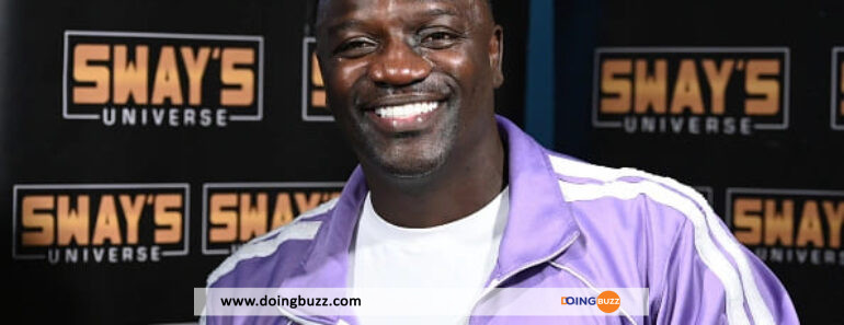 Akon : Voici La Folle Somme Qu&Rsquo;Il A Dépensée Pour Sa Greffe De Cheveux