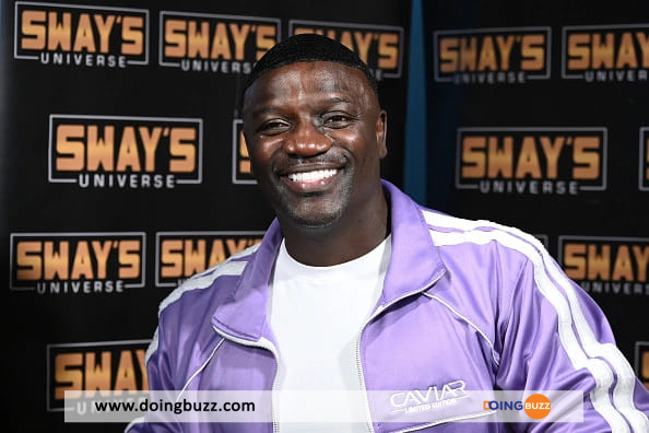 Akon : Voici La Folle Somme Qu'Il A Dépensée Pour Sa Greffe De Cheveux