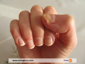 Vos Ongles Deviennent-Ils Jaunes ? Voici 5 Conseils Pour Les Réparer