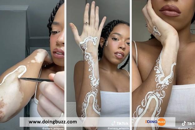 Insolite : elle transforme ses taches de vitiligo en œuvre d’art