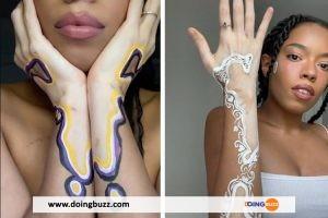 Insolite : Elle Transforme Ses Taches De Vitiligo En Œuvre D’art