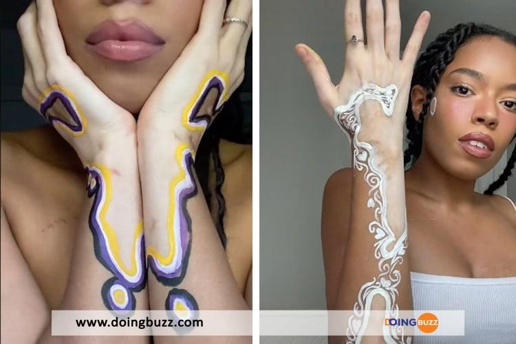 Insolite : elle transforme ses taches de vitiligo en œuvre d’art