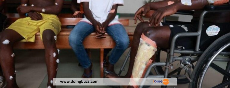 Cameroun : Dix-Neuf Athlètes Blessés Après Des Explosions Lors D&Rsquo;Une Course