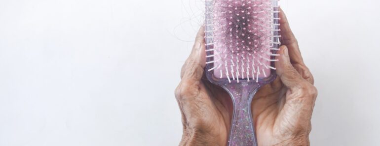 Comment Traiter L&Rsquo;Alopécie Et Stopper La Perte De Cheveux ? – Grazia