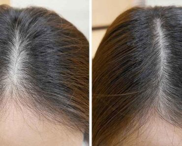 Comment Utiliser L&Rsquo;Huile De Ricin Pour Favoriser La Croissance Des Cheveux