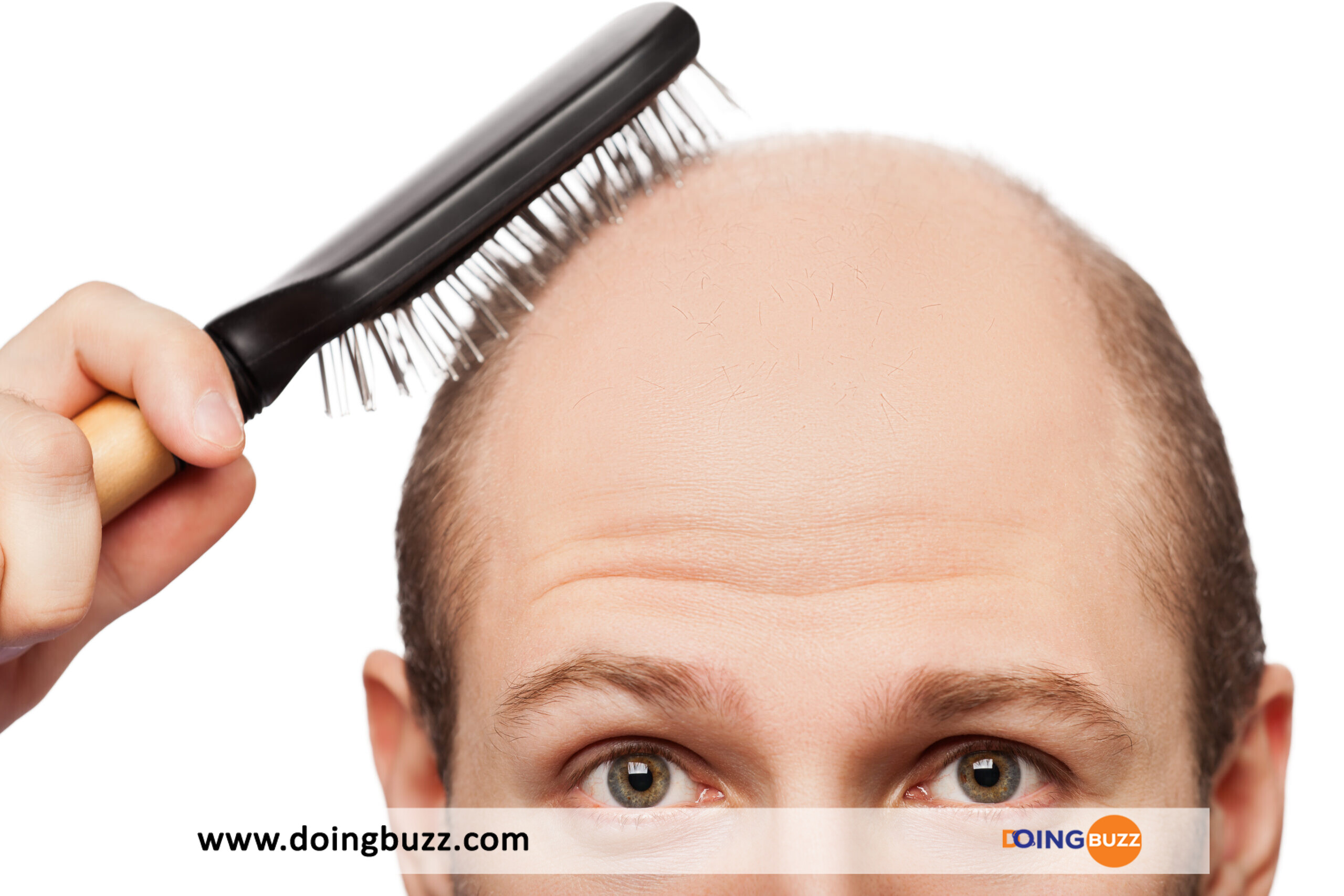 Hommes Chauves : Comment Faire Repousser Vos Cheveux ?