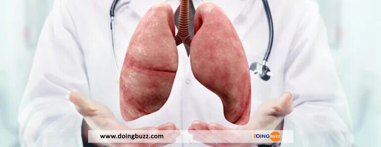Les Dangers Du Cancer Du Poumon Chez Les Non-Fumeurs : Symptômes À Connaître
