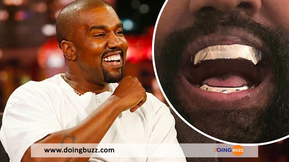 Kanye West Dévoile Son Dentier Inspiré De James Bond (Photos)