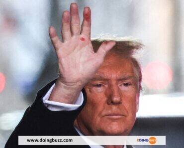 Donald Trump : Que signifient ces marques rouges sur sa main droite (PHOTOS)