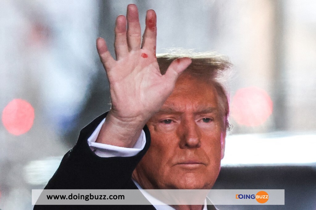 Donald Trump : Que Signifient Ces Marques Rouges Sur Sa Main Droite (Photos)