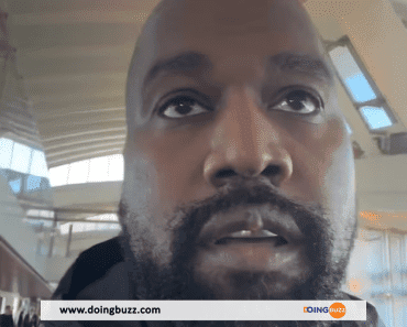 Kanye West : Sa lèvre supérieure déformée après une opération chirurgicale