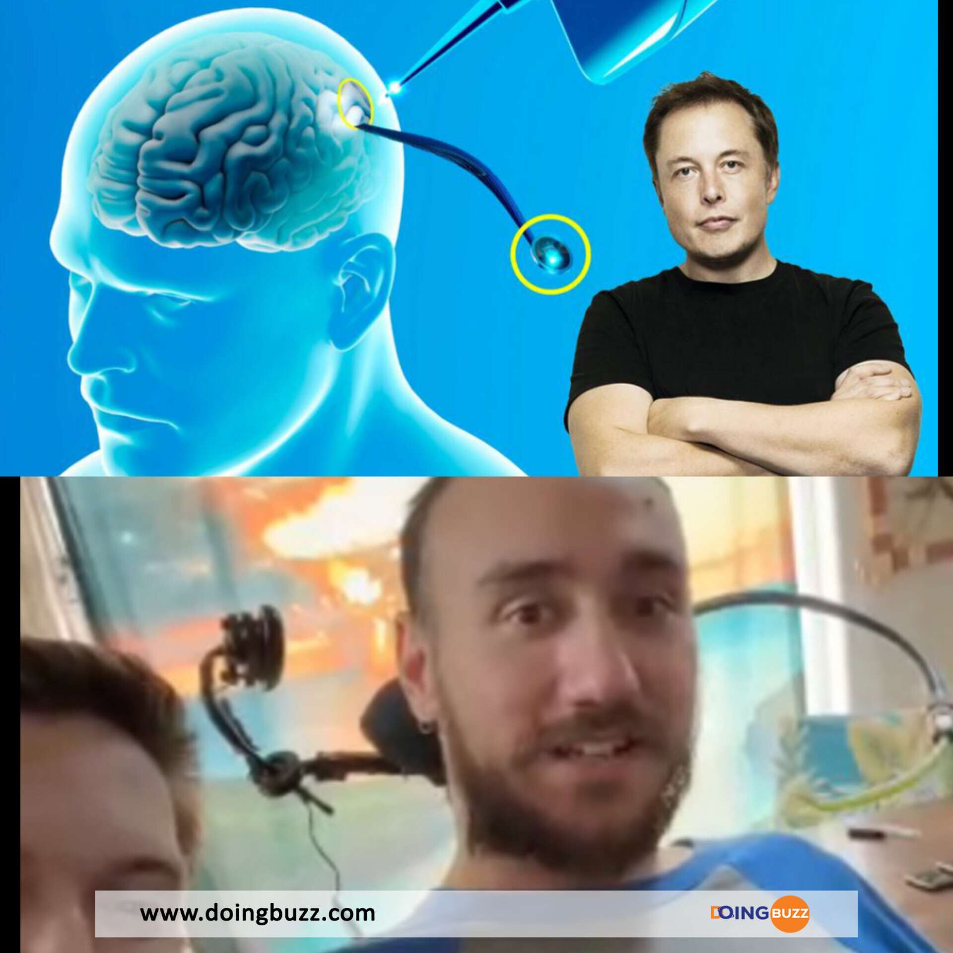 Neuralink : Le Premier Humain Équipé De La Puce Cérébrale D'Elon Musk Démontre Son Super Pouvoir (Vidéo)