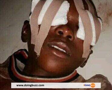 Nigéria : Les Yeux D&Rsquo;Un Jeune Garçon Brutalement Arrachés Par Des Ritualistes (Photos)