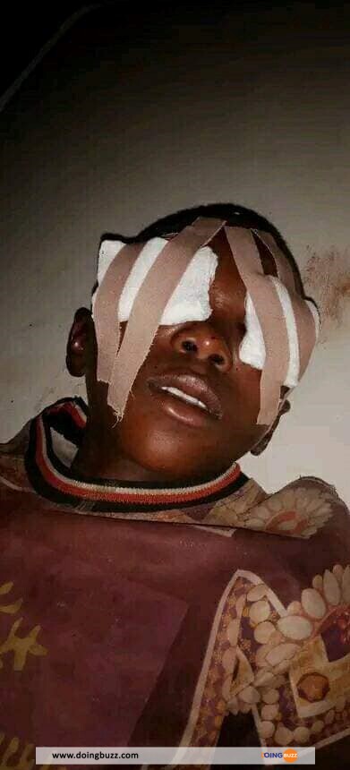 Nigéria : Les Yeux D'Un Jeune Garçon Brutalement Arrachés Par Des Ritualistes (Photos)