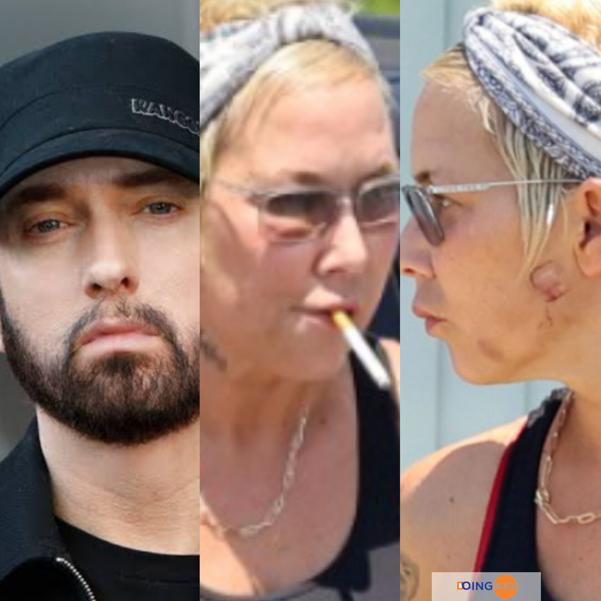Eminem, Ex-Femme, Kim Mathers, Blessure Au Visage