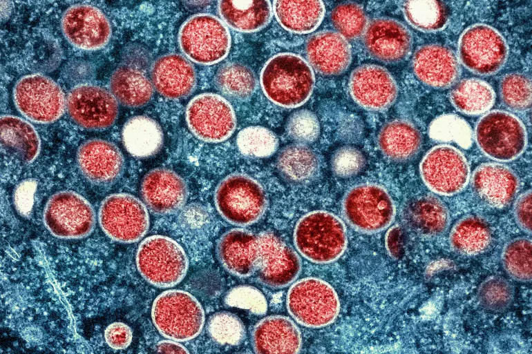 L'Oms Déclare L'Épidémie De Mpox Comme Une Urgence Sanitaire Mondiale